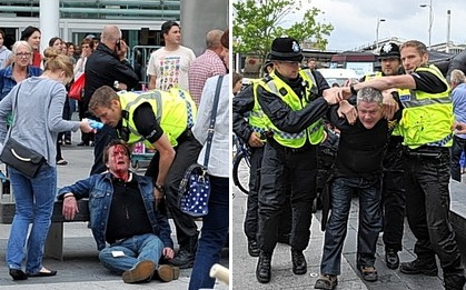 EDL assault Hull